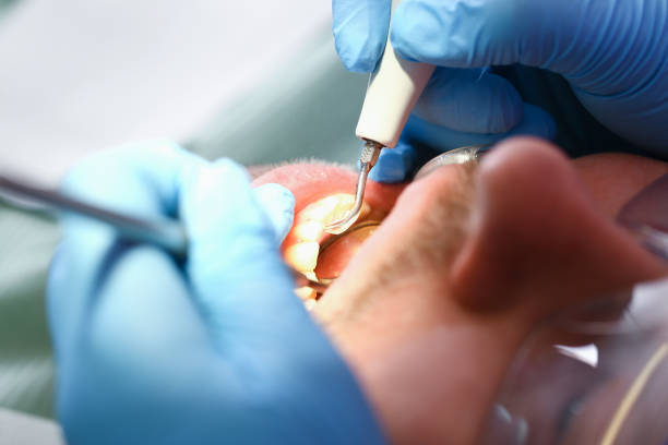 Best Emergency TMJ Treatment in Monroe, UT