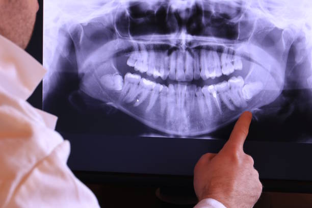 Best Emergency Gum Treatment in Monroe, UT